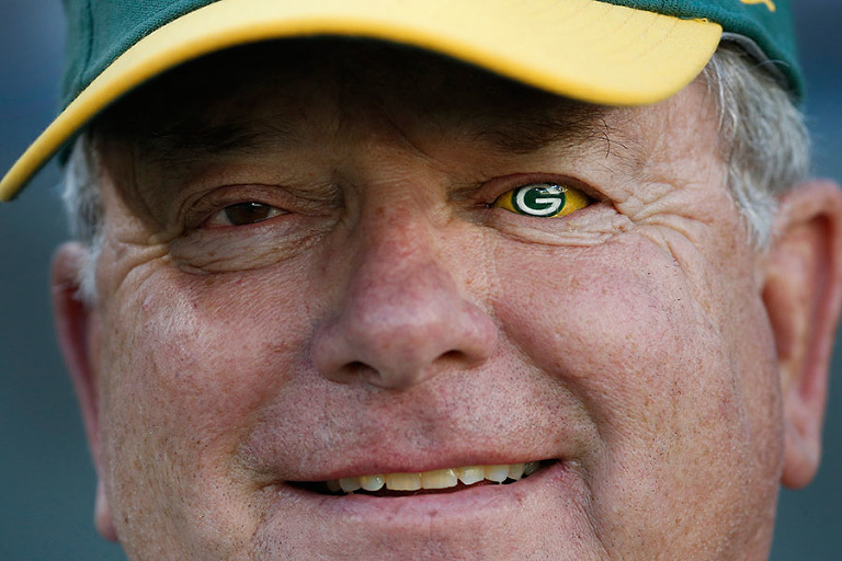 Leo Smith shows off his Packers pride with his prosthetic eye.